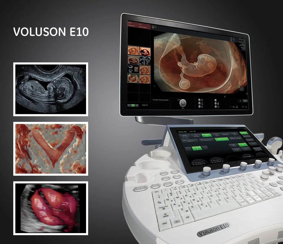 Imagem da Voluson E10